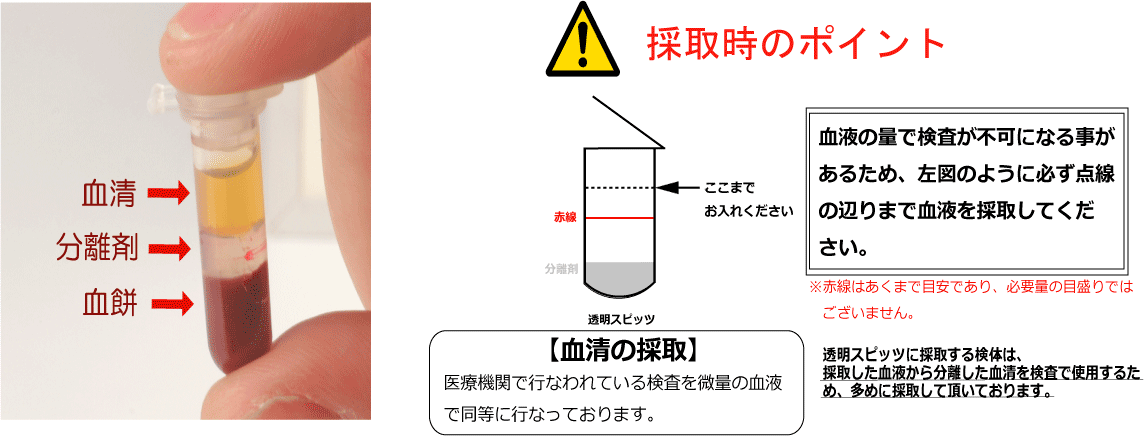 株式会社ヘルス ウェーブ ジャパン 生活習慣病検査 感染症検査 性病 Hiv クラミジア アレルギー検査 ガン検査 血液検査 血清 尿検査 セルフ ドック クラブ